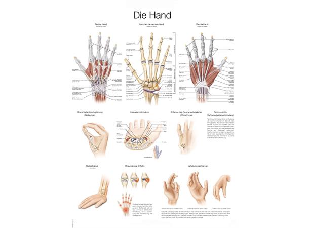 Plakat Hand and Wrist AL529