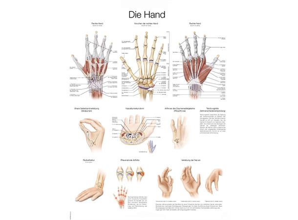 Plakat Hand and Wrist AL129