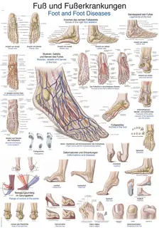 Plakat Foot and foot diseases